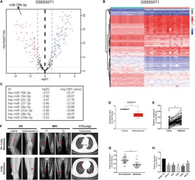 miR-766-3p Targeting BCL9L Suppressed Tumorigenesis, Epithelial-Mesenchymal Transition, and Metastasis Through the β-Catenin Signaling Pathway in Osteosarcoma Cells